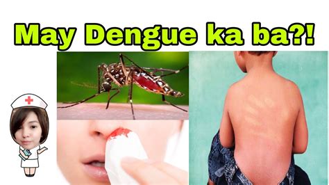 dengue symptoms kids tagalog